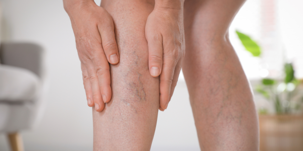 J’ai mal aux jambes / les jambes lourdes, que faire ?